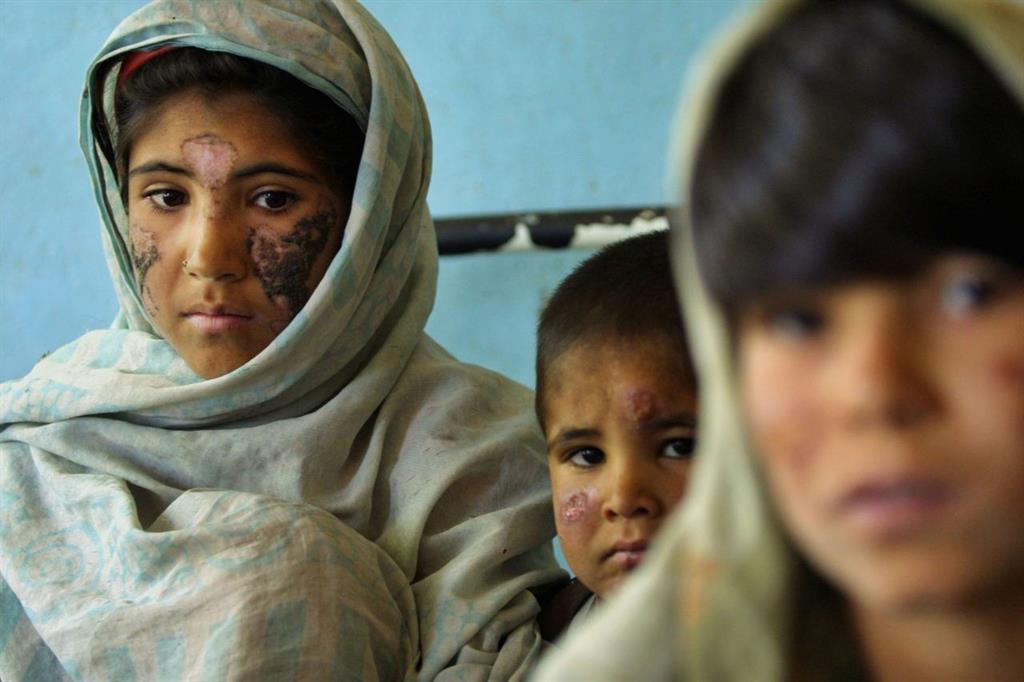 What is Leishmaniasis?
